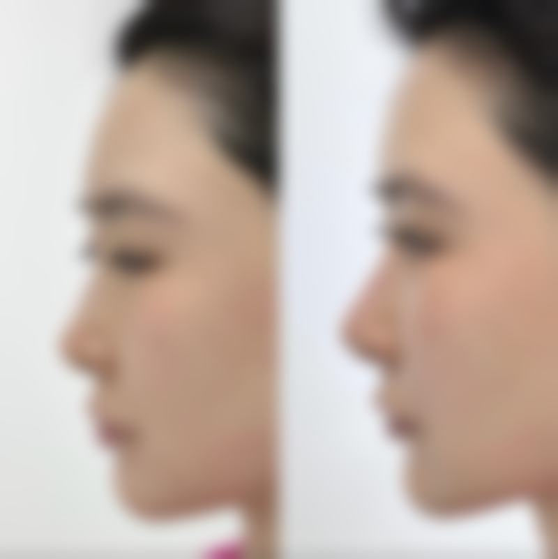 八、湘潭阳光医疗美容怎么预约?