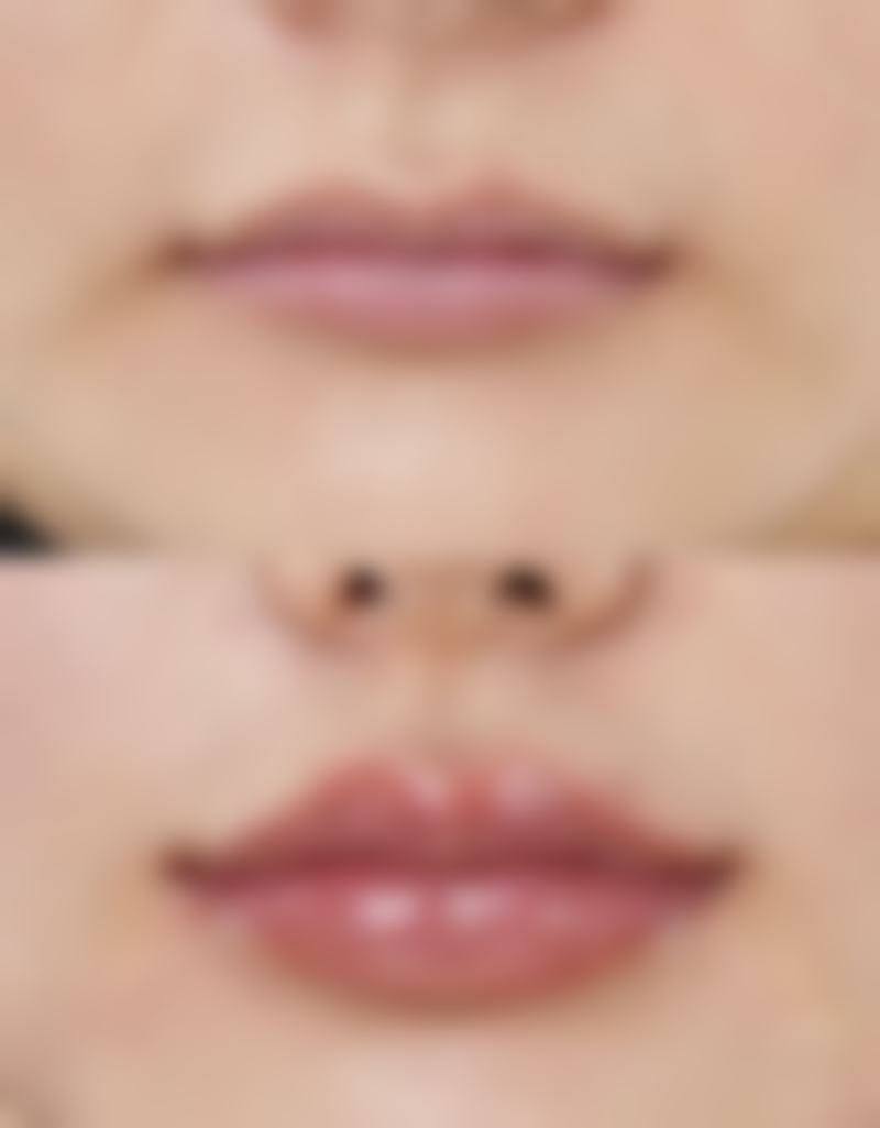 二、北京漾缇医疗美容董煦医生擅长项目