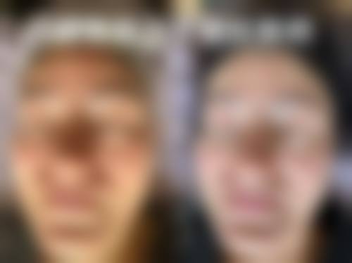 八、东莞东城君熠医疗美容诊所怎么预约?