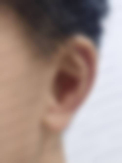 四、成都高新瑷尔博士整形医院特色项目