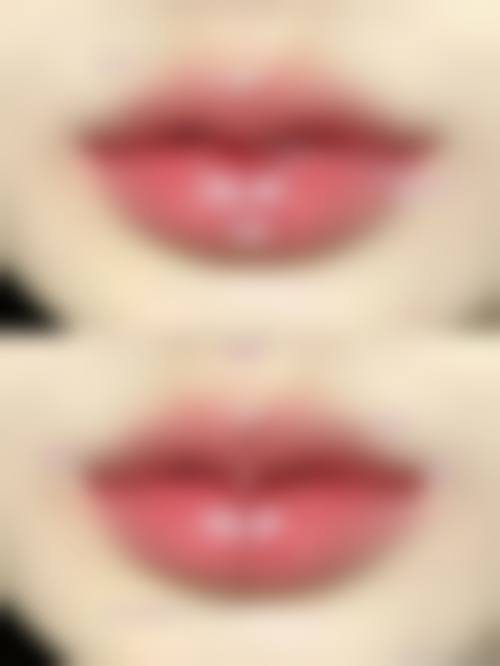 五、北京嫣然天使颅颜中 心美容医院收费价格表