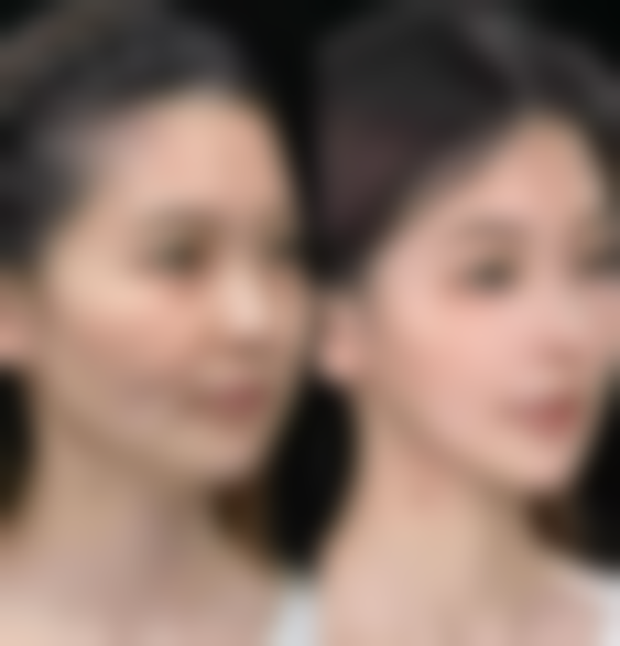 不同时间阶段的修复情况