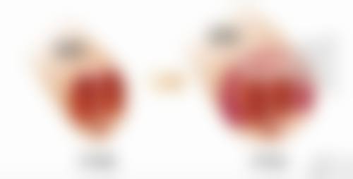 六、周口刘金刚医疗美容刘金刚医生口碑评价及真人实例反馈