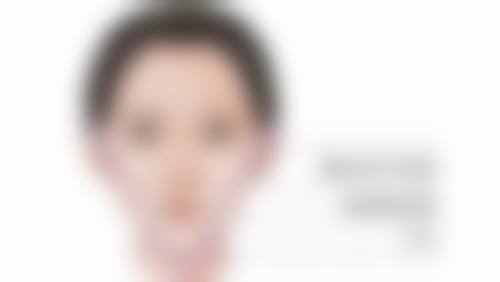 术前术后注意事项不能忘