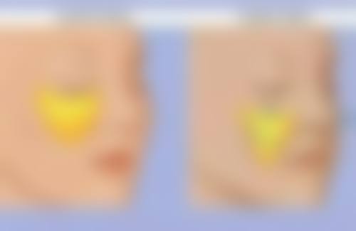 经期刚过可以割双眼皮吗？不建议马上割，考虑身体恢复等因素，月经过后5 - 7天更适宜！ 