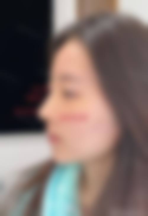 四、深圳阿芙罗医疗美容诊所特色项目