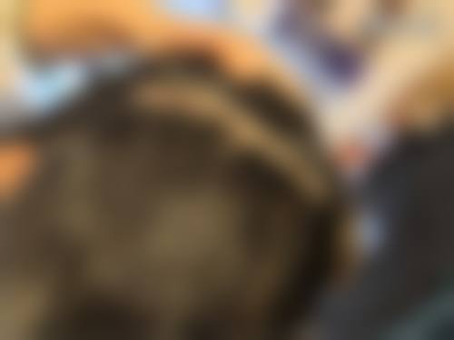 五、盐城雍禾植发收费价格表