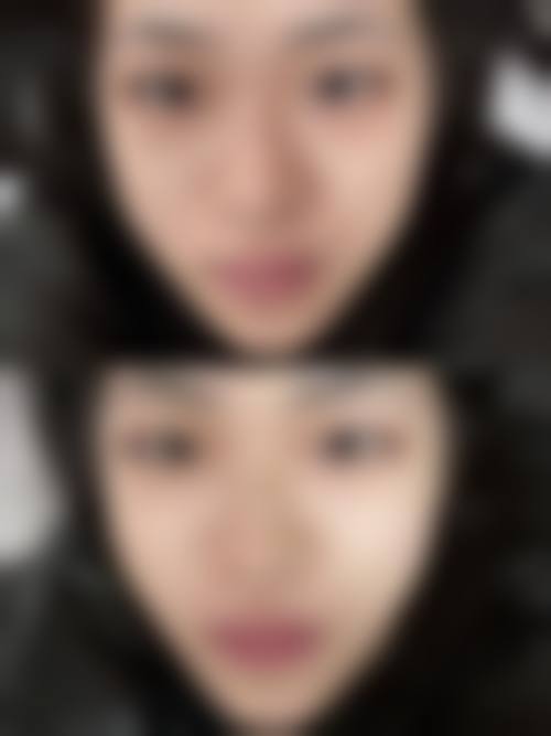 八、秦皇岛花惠医疗美容诊所怎么预约？