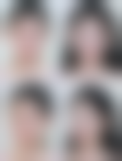 阴道紧缩术后多久可以同房？不同医生观点有差异，一般4 - 6周或6 - 8周，也有建议3个月！ 