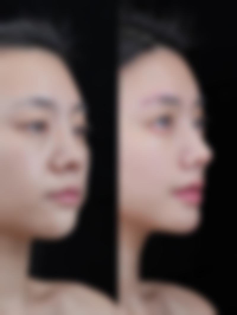 四、漳州华夏丽人医疗美容门诊部特色项目