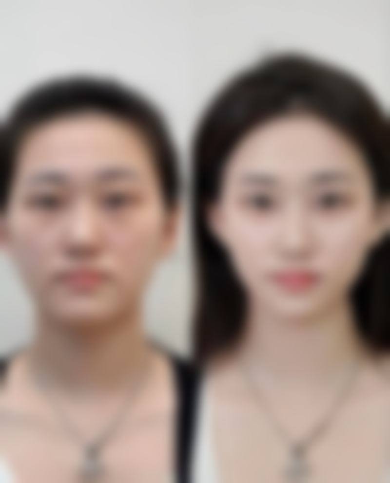 五、郑州至美医疗美容门诊部收费价格表