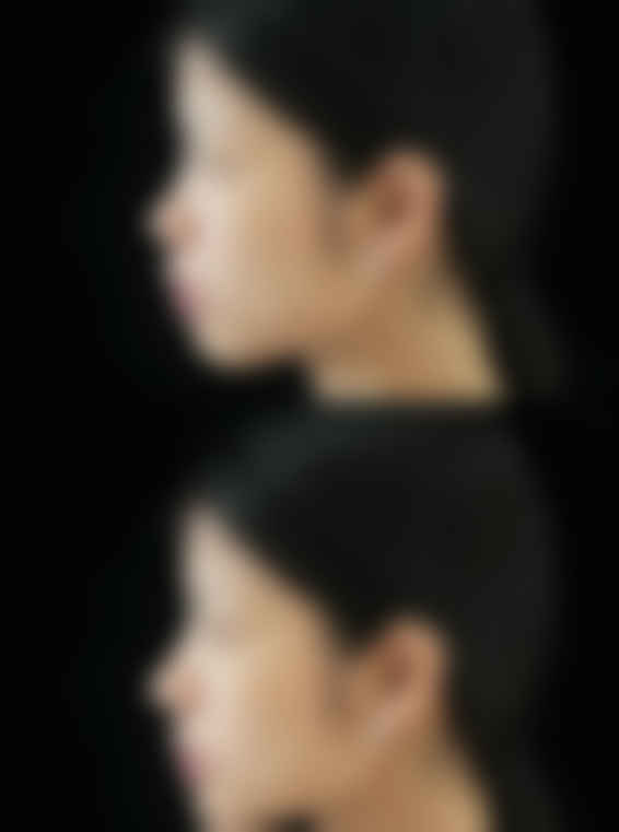 六、北京美雅枫医疗美容医院口碑如何？