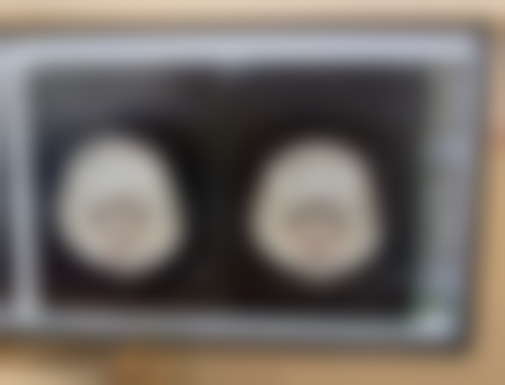 二、周口刘金刚医疗美容刘金刚医生擅长项目