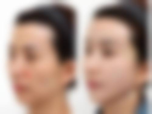 四、北京西美斯医疗美容诊所特色项目