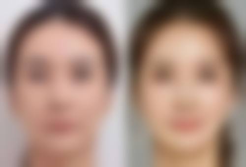 四、兰州斯美瑞医疗美容李士刚医生坐诊医院