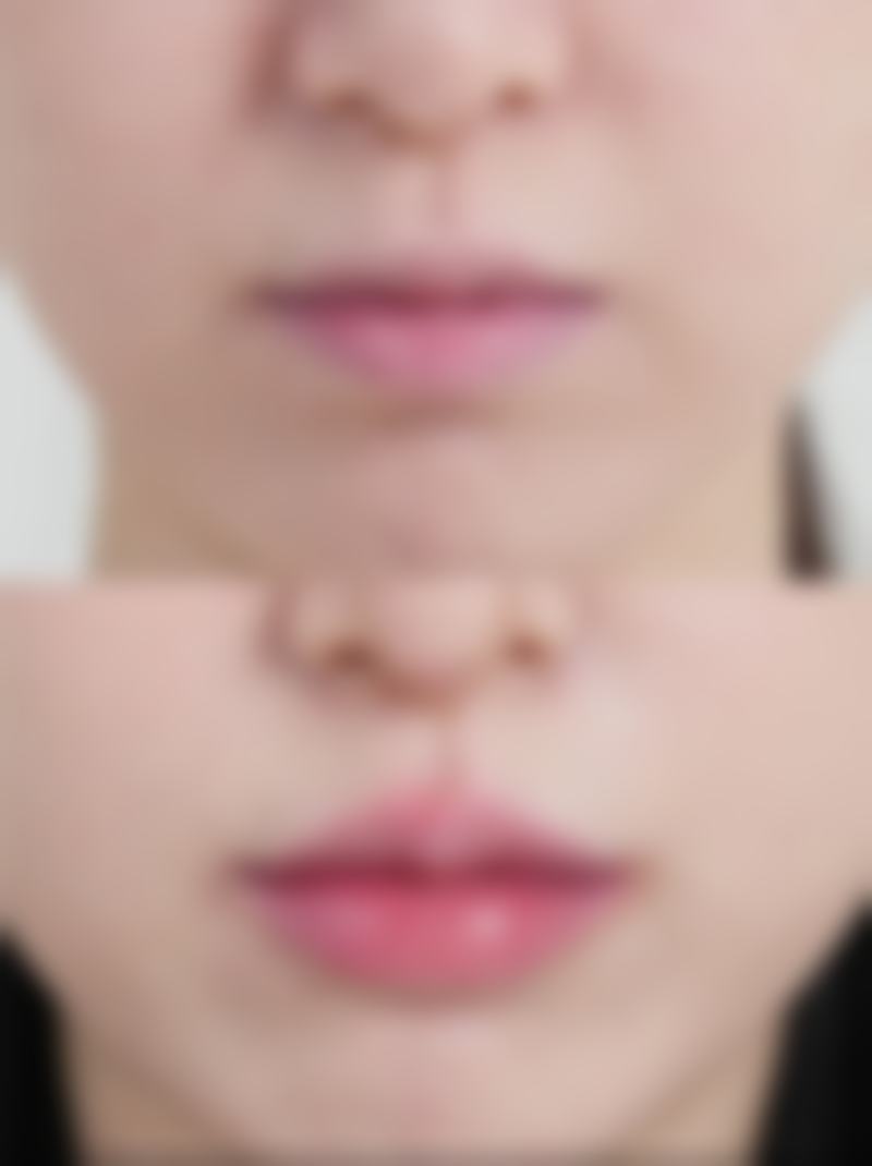 二、兰州斯美瑞医疗美容李士刚医生擅长项目