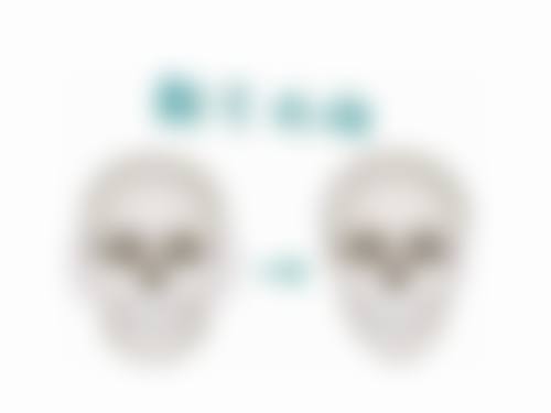 填充治疗凹陷疤痕