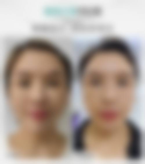 八、安康青美医疗美容怎么预约？