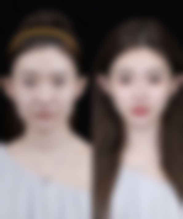 疾病及治疗因素干扰疤痕修复