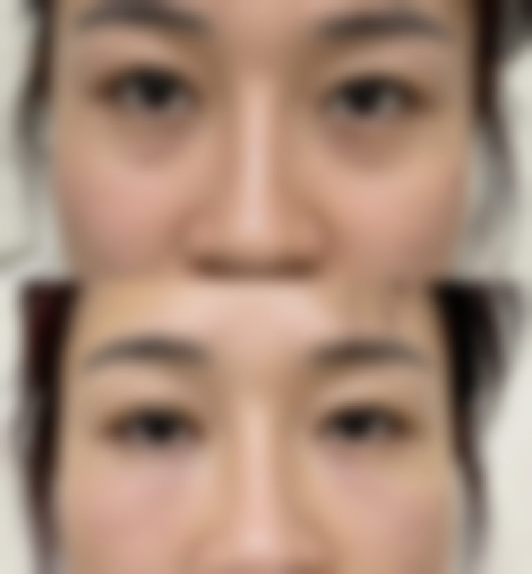 二、广州古汀医疗美容何兴鹏医生擅长项目