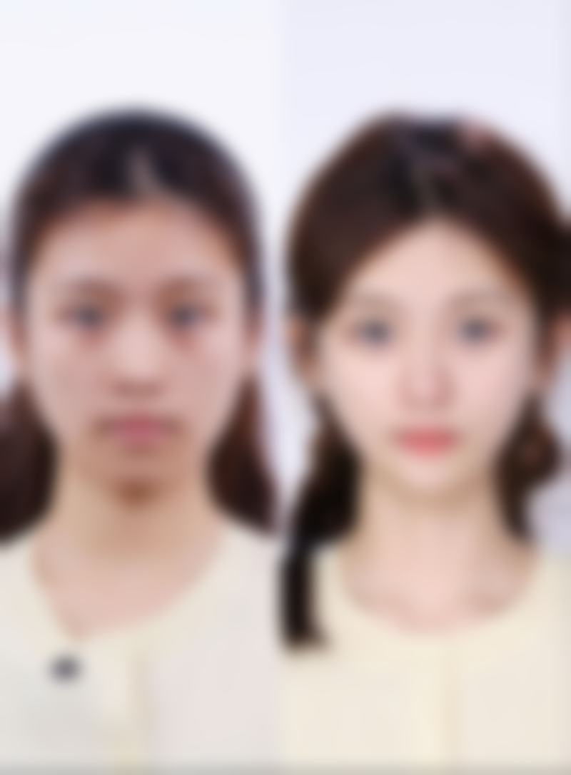 六、成都欣亚医疗美容诊所口碑如何？