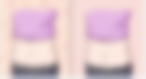 八、温州第三人民医院整形科怎么预约？