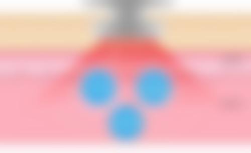 术后护理的重要性