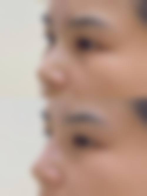 五、余姚妍美柏合医疗美容诊所收费价格表