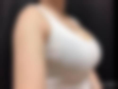 五、成都中瑞蜜美医疗美容诊所收费价格表