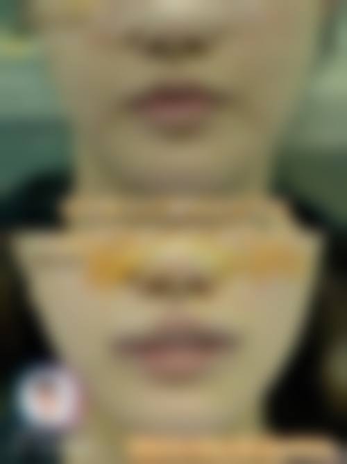 五、北京世纪坛医院整形美容中 心收费价格表