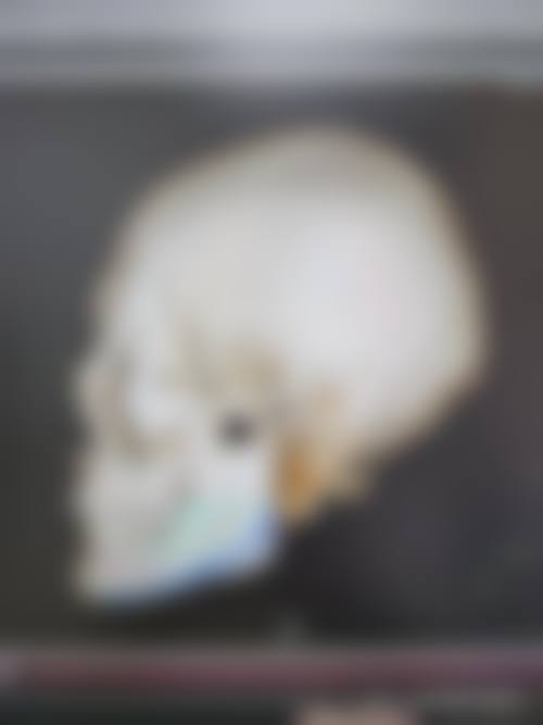 四、北京世纪坛医院整形美容中 心特色项目