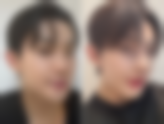 脂肪瘤治疗的其他选择