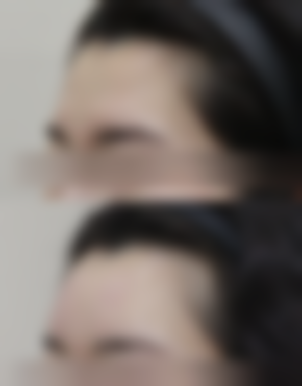 六、温州第三人民医院整形科口碑如何？