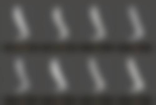 四、南京伊美莱医疗美容诊所特色项目