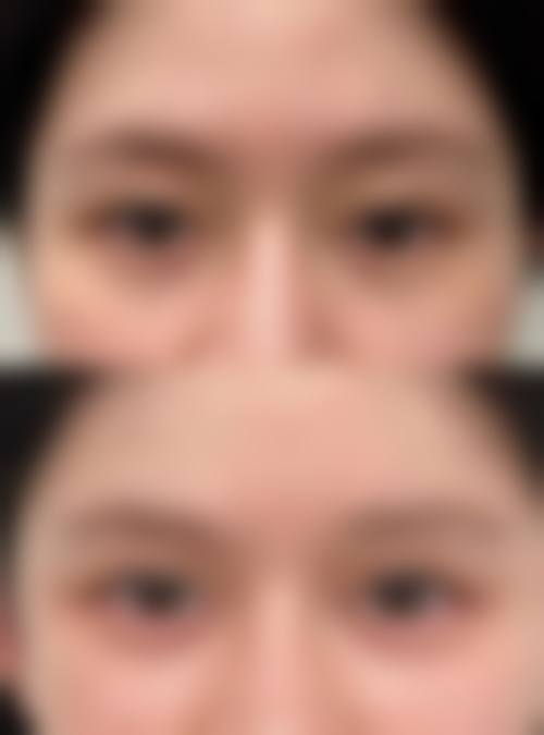 五、运城丽霞医疗美容诊所收费价格表