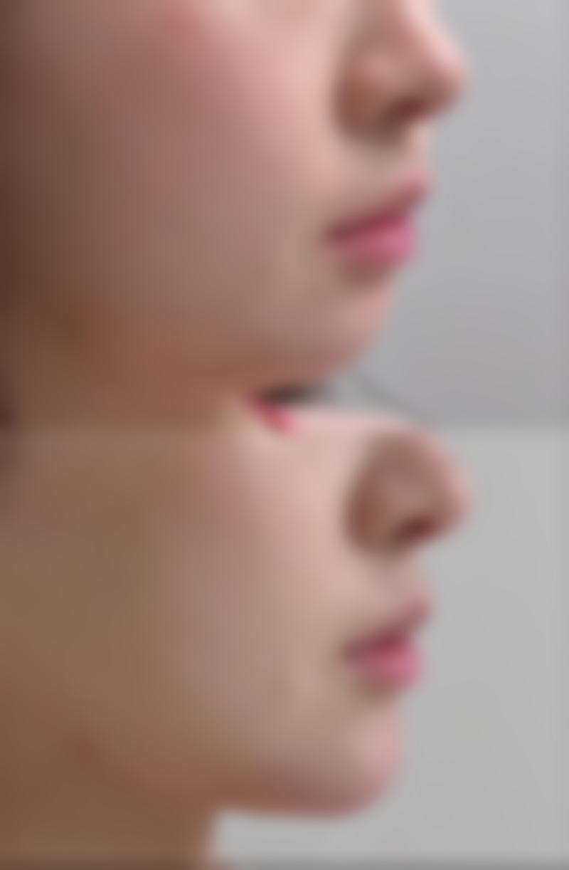 五、扬州邗江施尔美医疗美容整形袁金宝医生技术怎么样？