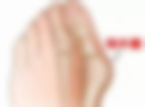 可以用别人的肋软骨隆鼻吗？一般不建议，排异风险大，自体肋软骨才是更安全的选择！ 