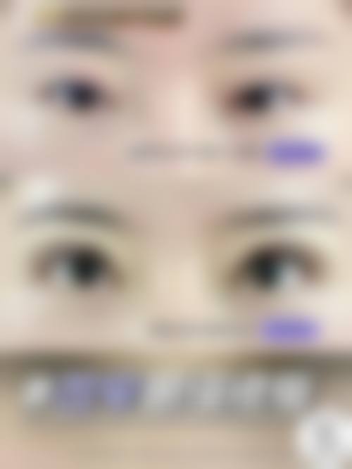 五、福州博美整形医院收费价格表