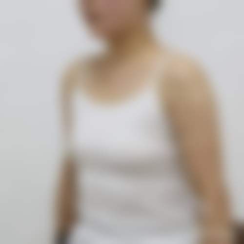 八、福州博美整形医院怎么预约？