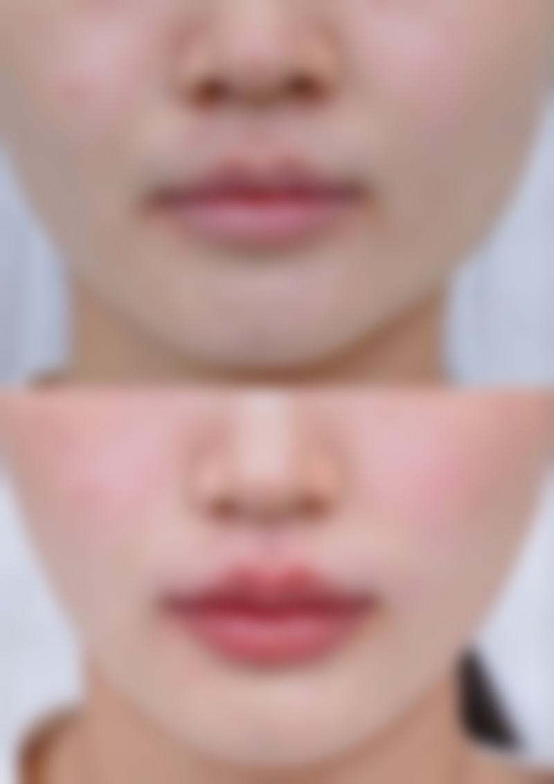 八、重庆淇沐汐整形医院怎么预约？