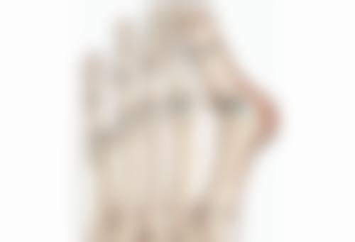 材料对埋线双眼皮维持时间的影响