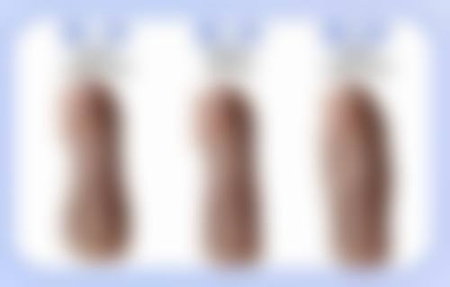 五、韩国DREAM梦想洪辰医生生技术怎么样？