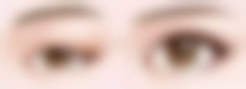 大腿腿部能抽脂吗？一般可行，但需结合脂肪堆积、厚度及个体状况判断，还有这些要注意！ 