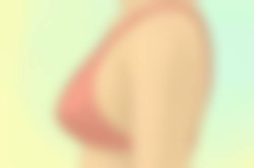 不同手术方式，用力抓的影响有别