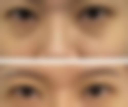 八、昆明安吉拉美容医疗诊所怎么预约？