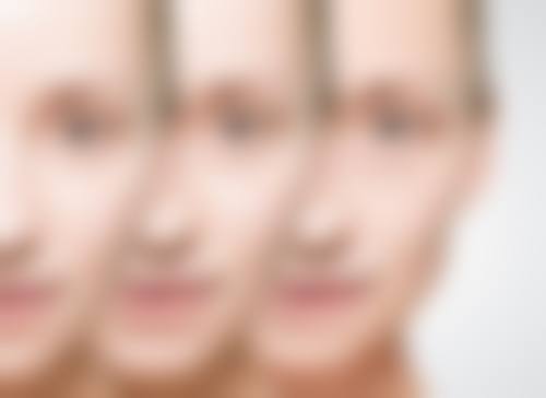 杭州悦可医疗美容诊所灵韵双眼皮术与其他双眼皮手术的对比