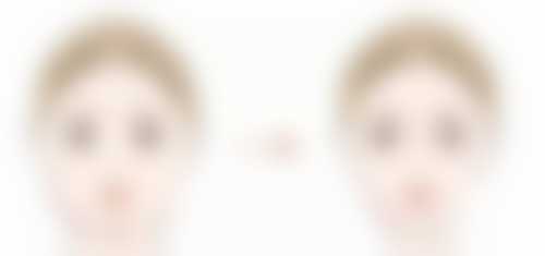 二、武汉天申整形胡丽医生擅长项目