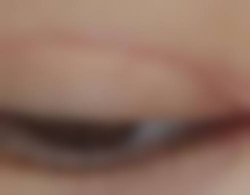 二、郑旻祐医生擅长项目