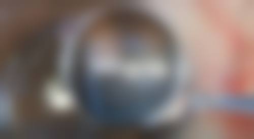 五、驻马店广济医院医疗美容蔡其贤医生技术怎么样？