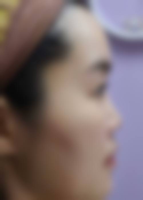 四、台州市立医院烧伤整形外科特色项目